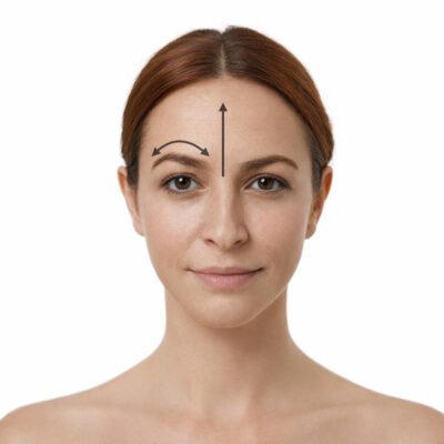 Arrugas del entrecejo - Clínica Estética Ibiza