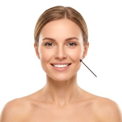 Aumento de Pómulos - Clínica Estética Ibiza